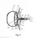 Fig. 11 - Systems and Methods for Cerebrospinal Fluid Repair