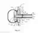 Fig. 14 - Systems and Methods for Cerebrospinal Fluid Repair