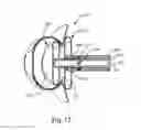 Fig. 15 - Systems and Methods for Cerebrospinal Fluid Repair