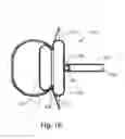 Fig. 18 - Systems and Methods for Cerebrospinal Fluid Repair