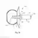 Fig. 20 - Systems and Methods for Cerebrospinal Fluid Repair
