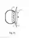 Fig. 27 - Systems and Methods for Cerebrospinal Fluid Repair