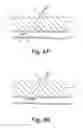 Fig. 05 - Methods for sealing a vascular puncture