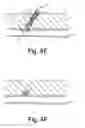 Fig. 07 - Methods for sealing a vascular puncture