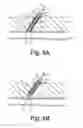 Fig. 08 - Methods for sealing a vascular puncture