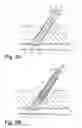 Fig. 12 - Methods for sealing a vascular puncture