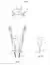 Fig. 09 - Spinal device comprising means of reversible fastening