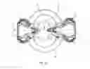 Fig. 10 - Spinal device comprising means of reversible fastening