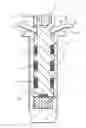 Fig. 01 - Internal joint bracing system and suture anchoring assembly therefore