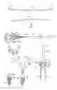 Fig. 01 - METHOD AND APPARTUS FOR REPAIRING A TENDON OR LIGAMENT