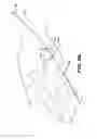 Fig. 04 - METHOD AND APPARTUS FOR REPAIRING A TENDON OR LIGAMENT