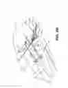 Fig. 06 - METHOD AND APPARTUS FOR REPAIRING A TENDON OR LIGAMENT