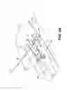 Fig. 07 - METHOD AND APPARTUS FOR REPAIRING A TENDON OR LIGAMENT