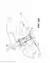 Fig. 09 - METHOD AND APPARTUS FOR REPAIRING A TENDON OR LIGAMENT