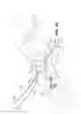 Fig. 20 - METHOD AND APPARTUS FOR REPAIRING A TENDON OR LIGAMENT