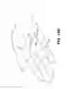 Fig. 43 - METHOD AND APPARTUS FOR REPAIRING A TENDON OR LIGAMENT