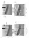 Fig. 59 - METHOD AND APPARTUS FOR REPAIRING A TENDON OR LIGAMENT