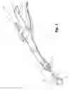Fig. 02 - Buttress support design for EEA anvil