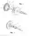 Fig. 04 - Buttress support design for EEA anvil