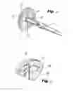 Fig. 07 - Buttress support design for EEA anvil