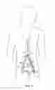 Fig. 02 - Device and method for establishing an artificial arterio-venous fistula