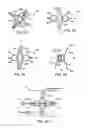 Fig. 09 - Device and method for establishing an artificial arterio-venous fistula