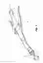 Fig. 02 - Surgical stapling apparatus including buttress attachment via tabs