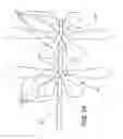 Fig. 16 - Methods and devices for the treatment of aneurysms