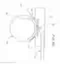Fig. 19 - Methods and devices for the treatment of aneurysms