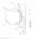 Fig. 20 - Methods and devices for the treatment of aneurysms