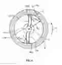 Fig. 07 - Tissue displacement tools and methods