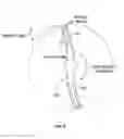 Fig. 09 - Tissue displacement tools and methods