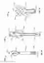 Fig. 45 - Tissue displacement tools and methods