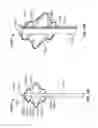 Fig. 72 - Tissue displacement tools and methods