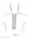 Fig. 28 - Vertebral facet joint drill and method of use