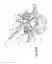 Fig. 48 - Vertebral facet joint drill and method of use