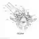 Fig. 76 - Vertebral facet joint drill and method of use