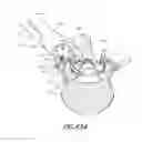 Fig. 78 - Vertebral facet joint drill and method of use