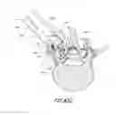 Fig. 80 - Vertebral facet joint drill and method of use