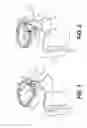 Fig. 02 - TISSUE EXTRACTION DEVICES AND RELATED METHODS
