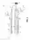 Fig. 03 - TISSUE EXTRACTION DEVICES AND RELATED METHODS