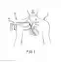 Fig. 02 - Multiple configuration surgical cutting device