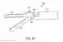 Fig. 30 - ULTRASONIC AND ELECTROSURGICAL DEVICES