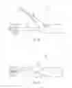 Fig. 05 - ULTRASONIC AND ELECTROSURGICAL DEVICES