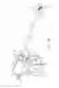 Fig. 48 - ULTRASONIC AND ELECTROSURGICAL DEVICES