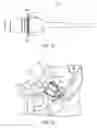 Fig. 33 - ULTRASONIC AND ELECTROSURGICAL DEVICES