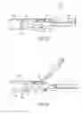 Fig. 28 - ULTRASONIC AND ELECTROSURGICAL DEVICES