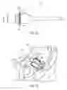 Fig. 33 - ULTRASONIC AND ELECTROSURGICAL DEVICES