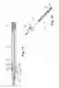 Fig. 06 - Rotational atherectomy device with exchangeable drive shaft and meshing gears