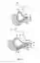 Fig. 16 - PUNCTURE APPARATUS